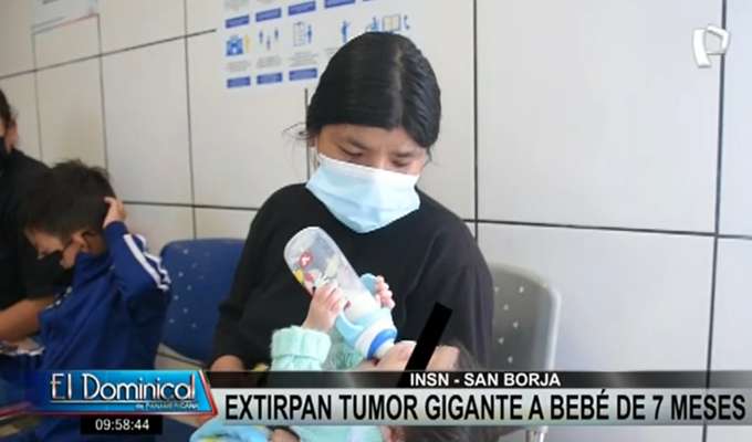 San Borja extirpan tumor gigante a bebé de