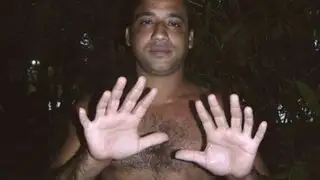 Ciudadano cubano tiene 24 dedos y asegura llevar una vida normal