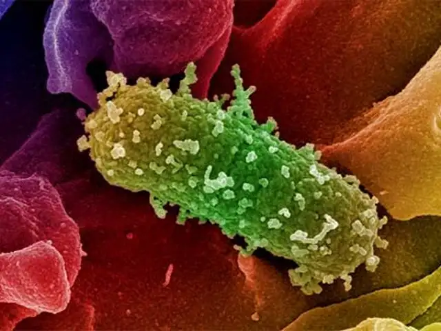 Cierran escuela en Alemania por precaución a la bacteria del E.coli