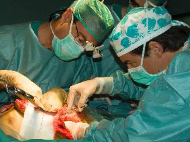 Médicos españoles implantaron el primer corazón artificial permanente