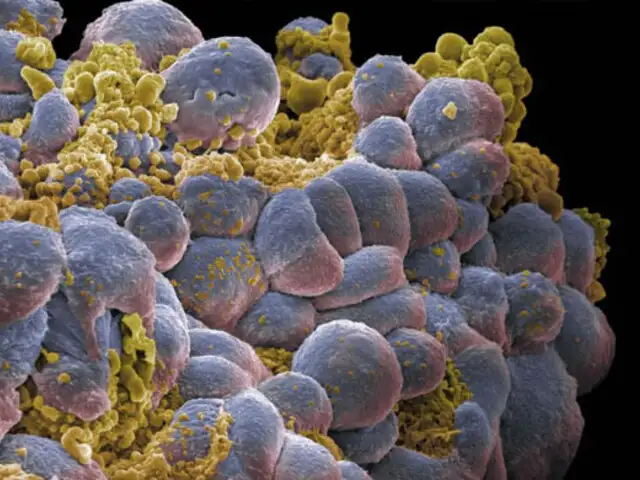 Nuevos descubrimiento sobre las células madres y el cáncer