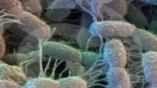 Desarrollan virus que mata células infectadas por el VIH