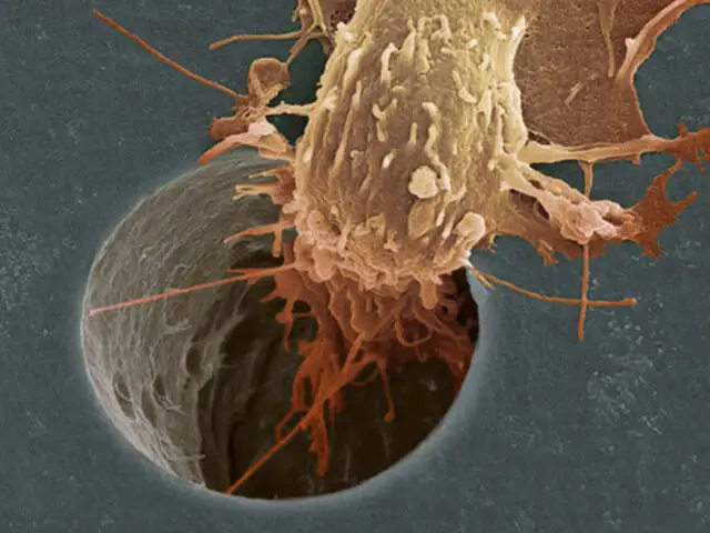 Identifican un nuevo compuesto que ataca el talón de Aquiles de las células cancerigenas