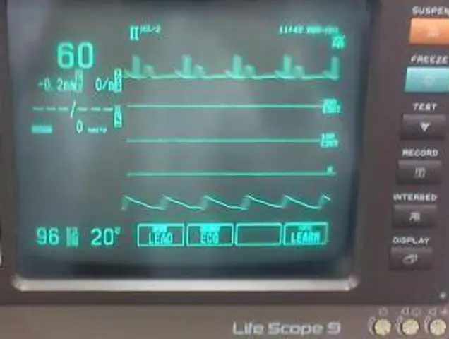 Diseñan circuito electrónico para medir signos vitales