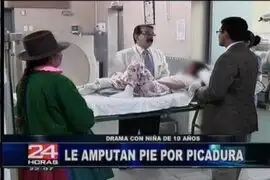 Denuncian hospital Unanue por amputar el pie a niña huancavelicana 