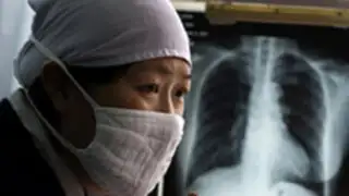 Estudian el uso del moxifloxaino para combatir la tuberculosis  