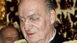 Rey Juan Carlos de España apareció con moretones en el rostro ante la prensa  