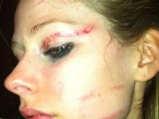 Avril Lavigne quedó con el ojo morado tras protagonizar una pelea callejera