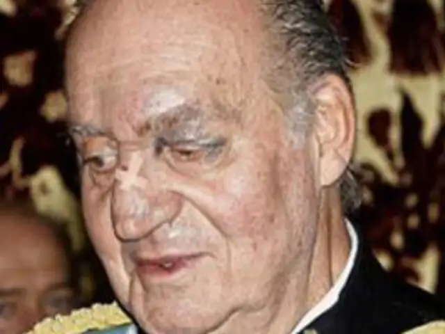 Rey Juan Carlos de España apareció con moretones en el rostro ante la prensa  