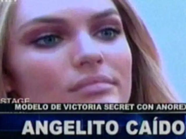 Modelo de Victoria Secret seria victima de la Anorexia  