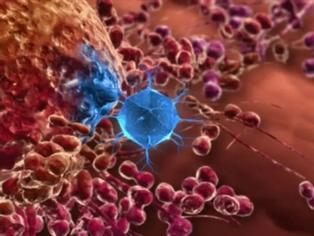 Virus de Papiloma Humano puede producir múltiples tipos de cáncer