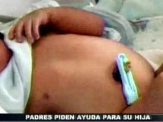 Jaén: padres piden ayuda para bebé que nació con extraña malformación