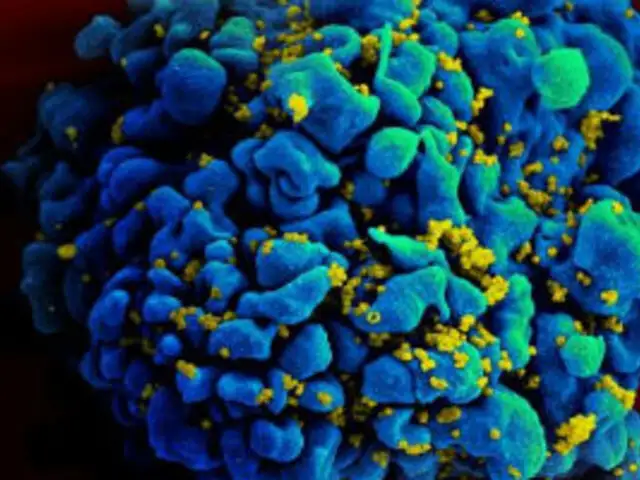Científicos españoles hallan molécula clave en expansión del VIH