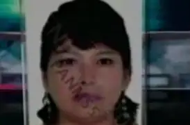 Desesperada mujer se quita la vida tomando raticida en Los Olivos