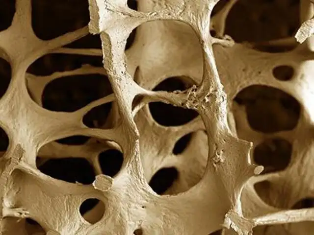 La NASA desarrolla test de orina para detectar osteoporosis