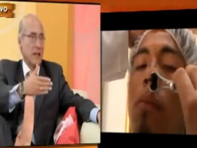 La cirugía a la nariz es la más requerida por jóvenes peruanos