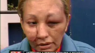 Ventanilla: mujer desfigurada por su pareja pide parar violencia