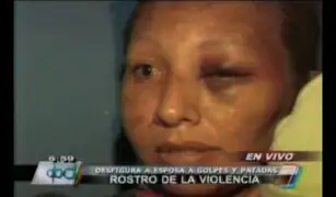 Mujer agredida brutalmente por su pareja: Él era una persona buena