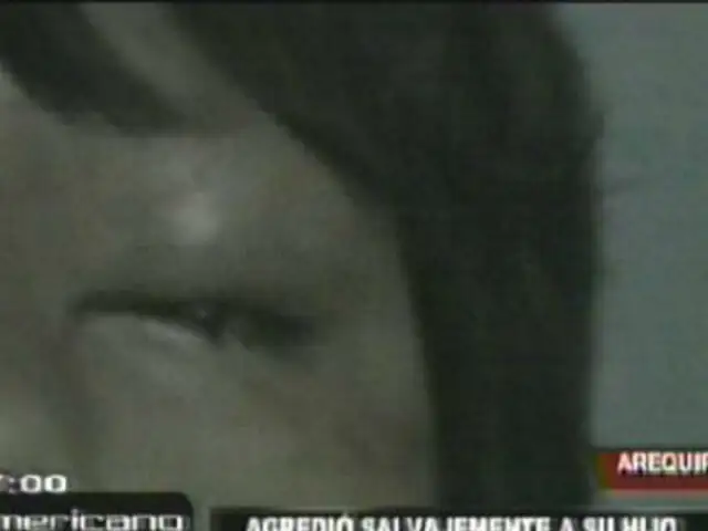 Arequipa: padre enfurecido golpea brutalmente a menor de ocho años