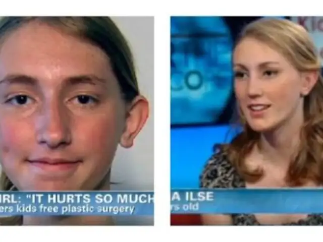 Escolar de 14 años se somete a una cirugía plástica tras sufrir bullying