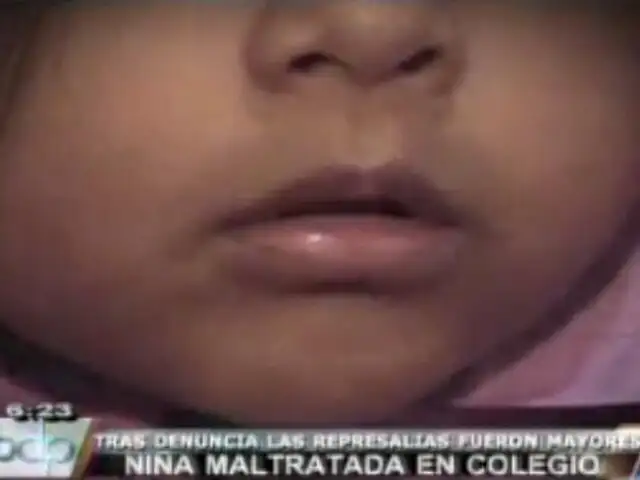 Niña es víctima de maltratos en su colegio en San Juan de Lurigancho