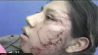 Sujeto desfigura rostro de esposa tras atacarla a pedradas