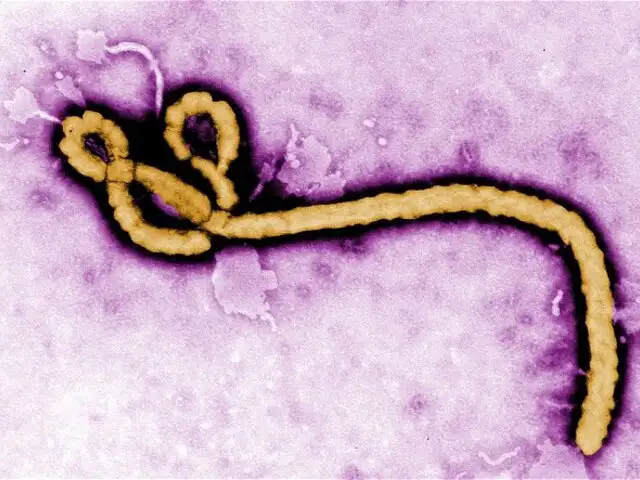 Brote de Ébola al noreste del Congo alarma a la ONU.