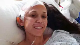 EEUU: retiran parte del cráneo a una mujer y se lo implantan en el estómago
