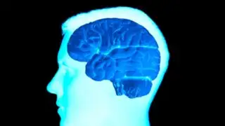 Científicos descubrieron origen inesperado de los tumores cerebrales