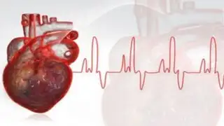 Arritmias ligadas a cardiopatías deben llevar tratamiento permanentemente