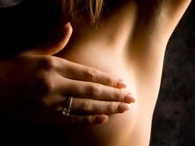 Médicos recomiendan Mastectomía en pacientes de alto riesgo