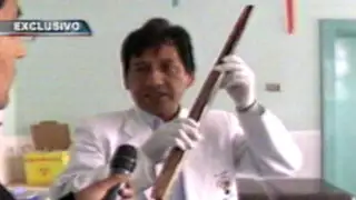 Cusco: habla ‘Doctor imposible’ que quitó estaca del cráneo a paciente