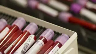 EEUU: crean prueba de sangre capaz de detectar el cáncer