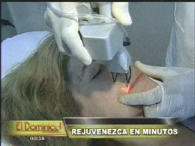 Lo último en tratamientos parea rejuvenecer tan solo en minutos