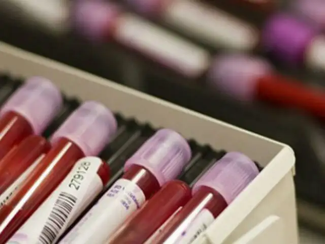 EEUU: crean prueba de sangre capaz de detectar el cáncer