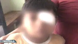 Trujillo: niño podría perder el ojo tras jugar con un ‘rascapié’