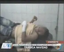 Chimbote: joven perdió cuadro dedos al manipular “Rata Blanca”