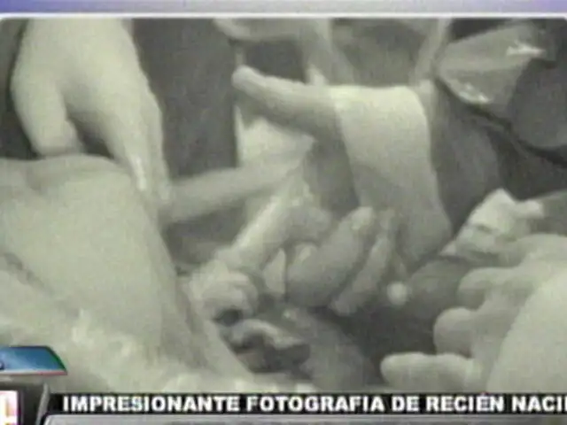 Sorprendente imagen de bebé que agarra el dedo de su médico al nacer
