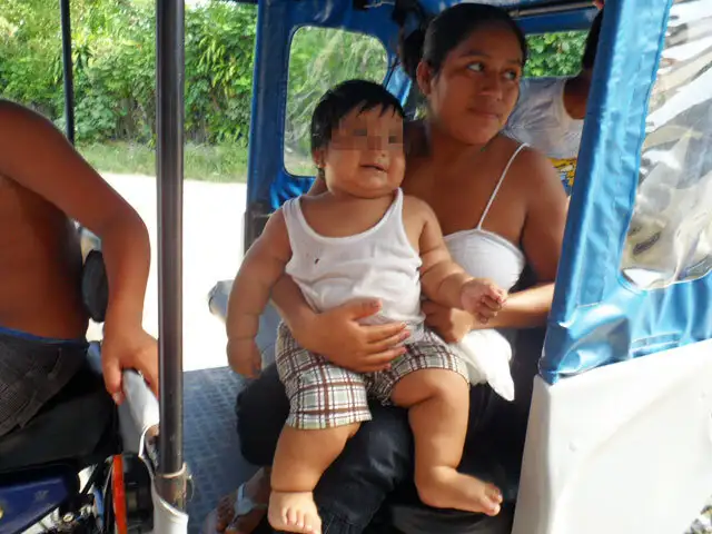 Yurimaguas: bebé de 8 meses pesa más de 15 kilos y requiere tratamiento