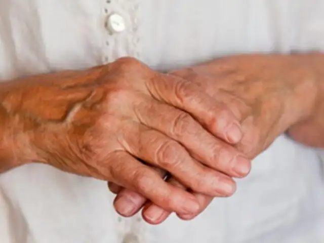 Riesgo de artritis reumatoide podría ser reducida exponiéndose al sol