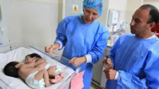 Padre de siamesas operadas con éxito pide a Humala apadrinar a las niñas