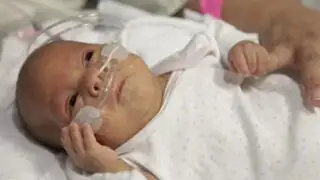 Médicos implantan tráquea "impresa" en 3D para salvar la vida a un bebé