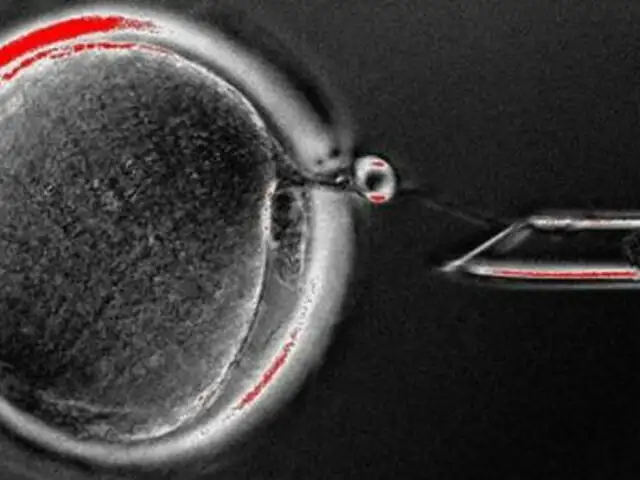 Estadounidenses logran clonar por primera vez células madre humanas