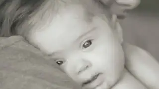 Bebé con síndrome de Down encuentra más de 100 padres adoptivos