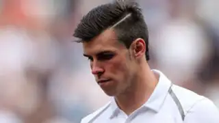Bale se sometió a tomografía para descartar una lesión de gravedad