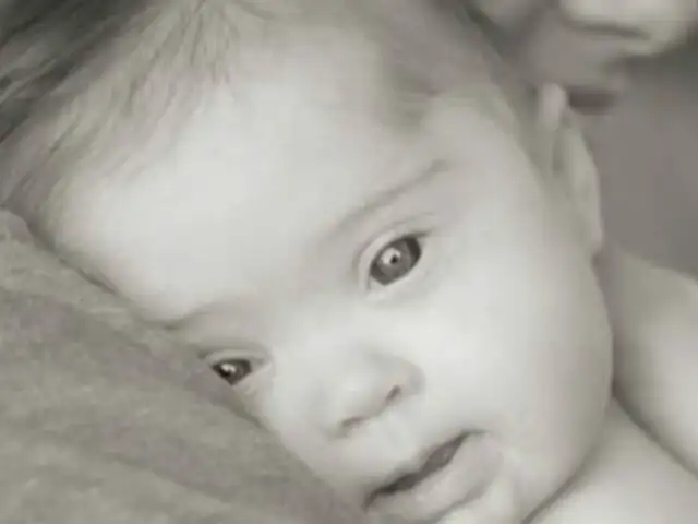 Bebé con síndrome de Down encuentra más de 100 padres adoptivos