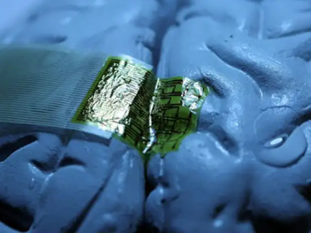 EEUU: Google intenta desarrollar un chip implantable en el cerebro humano