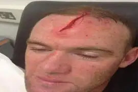 Wayne Rooney sufrió un terrible corte en la cabeza tras chocar con su compañero