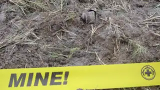Colombiano perdió un pie tras pisar mina antipersonal en frontera de Perú y Chile