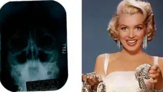 Marilyn Monroe se sometió a una cirugía plástica de nariz y barbilla